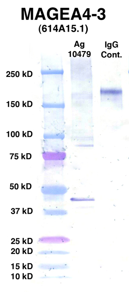 Click to enlarge image Western Blot using CPTC-MAGEA4-3 as primary Ab against Ag 10479 (lane 2).
Also included are molecular wt. standards (lane 1) and mouse IgG control (lane 3).