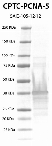 Click to enlarge image Western Blot using CPTC-PNCA-5 as primary Ab against recombinant PNCA protein (lane 2). Also included are molecular wt. standards (lane 1).
