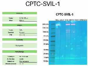 Click to enlarge image Western blot using CPTC-SVIL-1 as primary antibody against the whole lysates of HeLa, UO-31, TK-10, SNB-19, MOLT-4, and RPMI-8226. The antibody detected the target protein (~247.7 KDa) in HeLa, TK-10, and SNB-19 cell lysates.
