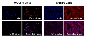Click to enlarge image Immunofluorescence staining using CPTC-SVIL-2 as primary antibody (pink-violet) against MOLT-4 and SNB19 cells.  Both cell lines show SVIL protein subcellular localization in the cell membrane, cytoskeleton and cytoplasm.