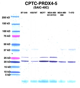 Click to enlarge image Western Blot using CPTC-PRDX4-5 as primary Ab against lysates from six breast cancer cell lines from the NCI60 cell line collection (lanes 2-7). Also included are molecular wt. standards (lane 1).