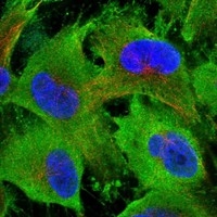 Click to enlarge image Results provided by the Human Protein Atlas (www.proteinatlas.org). The subcellular location is supported by literature. Immunofluorescent staining of human cell line U-251 MG shows localization to plasma membrane & cytosol.  Human assay: A-431 fixed with PFA, dilution: 1:30 Human assay: U-2 OS fixed with PFA, dilution: 1:30 Human assay: U-251 MG fixed with PFA, dilution: 1:30