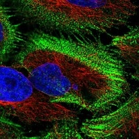 Click to enlarge image Results provided by the Human Protein Atlas (www.proteinatlas.org).  The subcellular location is partly supported by literature or no literature is available. Immunofluorescent staining of human cell line HeLa shows localization to plasma membrane & actin filaments. 
Human assay: HeLa fixed with PFA, dilution: 1:2000
Human assay: MCF7 fixed with PFA, dilution: 1:2000
Human assay: U-2 OS fixed with PFA, dilution: 1:2000