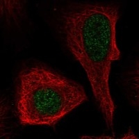 Click to enlarge image Results provided by the Human Protein Atlas (www.proteinatlas.org). The subcellular location is supported by literature. Immunofluorescent staining of human cell line U2OS shows localization to nucleoplasm. Human assay: THP-1 fixed with PFA, dilution: 1:100
Human assay: U2OS fixed with PFA, dilution: 1:100