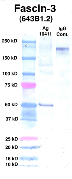 Click to enlarge image Western Blot using CPTC-Fascin-3 as primary Ab against CPTC-Fascin (Ag 10411) (lane 2). Also included are molecular wt. standards (lane 1) and mouse IgG control (lane 3).