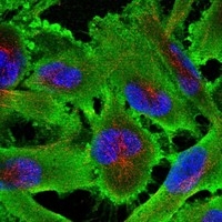 Click to enlarge image Results provided by the Human Protein Atlas (www.proteinatlas.org). The subcellular location is partly supported by literature or no literature is available. Immunofluorescent staining of human cell line U-251 MG shows localization to plasma membrane & cytosol. 
Human assay: A-431 fixed with PFA, dilution: 1:30
Human assay: U-2 OS fixed with PFA, dilution: 1:30
Human assay: U-251 MG fixed with PFA, dilution: 1:30