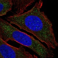 Click to enlarge image Results provided by the Human Protein Atlas (www.proteinatlas.org). The subcellular location is partly supported by literature or no literature is available. Immunofluorescent staining of human cell line U2OS shows localization to cytosol.

Human assay: THP-1 fixed with PFA, dilution: 1:100
Human assay: U2OS fixed with PFA, dilution: 1:100