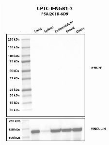Click to enlarge image Western blot using CPTC-IFNGR1-3 as primary antibody against human lung (2), spleen (3), endometrium (4), breast (5), and ovary (6) tissue lysates. The expected molecular weight is 54.4 kDa and 21.5 kDa. Vinculin was used as a loading control.