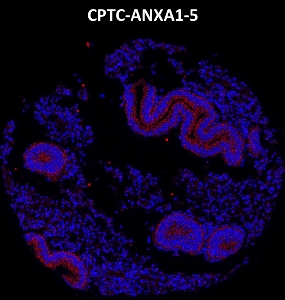 Click to enlarge image Imaging mass cytometry on normal endometrium tissue core using CPTC-ANXA1-5 metal-labeled antibody.  Data shows overlay of target protein signal (red) and DNA (blue). Dilution: 1:100 of 0.5mg/mL stock. Signal was also obtained in other normal tissues (liver, colon, endometrium, bone marrow, and breast) and cancer tissues (breast, colon, lung, and ovarian).