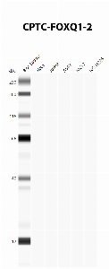 Click to enlarge image Automated Western Blot using CPTC-FOXQ1-2 as primary antibody against cell lysates A549, H226, HeLa, Jurkat and MCF7. Expected MW of 41.5 KDa. All cell lysates negative.  Molecular weight standards are also included (lane 1).