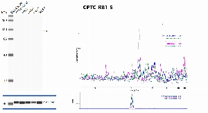 Click to enlarge image Automated western blot using CPTC-RB1-5 as primary antibody against whole cell lysates of cell lines CCRF-CEM, HeLa, Jurkat, K-562 and MCF7. Protein molecular weight is about 106 KDa. The antibody cannot recognize the target in any of the tested lysates. Loading controls were run with anti-GAPDH antibody.