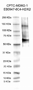 Click to enlarge image Western Blot using CPTC-MDM2-1 as primary antibody against human recombinant Mdm2 p53 binding protein (lane 2). Also included are molecular weight standards (lane 1).