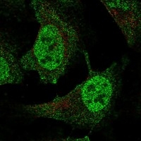 Click to enlarge image Results provided by the Human Protein Atlas (www.proteinatlas.org). The subcellular location is supported by literature. Immunofluorescent staining of human cell line U-2 OS shows localization to nucleoplasm. 
Human assay: A-431 fixed with PFA, dilution: 1:200
Human assay: U-2 OS fixed with PFA, dilution: 1:200
Human assay: U-251 MG fixed with PFA, dilution: 1:200