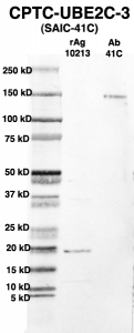 Click to enlarge image Western Blot using CPTC-UBE2C-3 as primary Ab against full-length recombinant Ag 10213 (lane 2). Also included are molecular wt. standards (lane 1) and the UBE2C-3 Ab as positive control (lane 3).