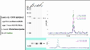 Click to enlarge image Automated WB (Simple Western) using CPTC-EIF2A-2 as primary antibody against the whole lysate of breast, ovary, spleen, endometrium and lung tissues. Expected MW is 65 Kda. The antibody recognizes the target in tested lysates. The same cell lysates were probed with an anti-CytC antibody (bottom panel).