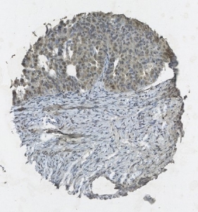 Click to enlarge image Tissue Microarray core immunohistochemically stained with antibody CPTC-PTEN-5