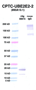 Click to enlarge image Western Blot using CPTC-UBE2E2-2 as primary Ab against UBE2E2 (rAg 00015) (lane 2). Also included are molecular wt. standards (lane 1) and mouse IgG control (lane 3).