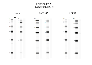 Click to enlarge image Automated western blot using CPTC-PARP1-2 as primary antibody against cell lysates HeLa, MCF10A, and LCL57.  Samples from each cell line were irradiated with 10 Gy as shown in ‘+’ indicated lanes. Samples from each non-irradiated cell line were treated with alkaline phosphatase enzyme as shown in ‘-‘ indicated lanes. Molecular weight standards are also included.