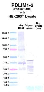 Click to enlarge image Western Blot using CPTC-PDLIM1-2 as primary Ab against cell lysate from transiently overexpressed HEK293T cells form Origene (lane 3). Also included are molecular wt. standards (lane 1), lysate from non-transfected HEK293T cells as neg control (lane 4) and recombinant Ag PDLIM1 (NCI 10044) in (lane 2). 