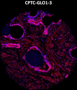 Click to enlarge image Imaging mass cytometry on normal prostate tissue core using CPTC-GLO1-3 metal-labeled antibody.  Data shows an overlay of the target protein signal (red) and DNA (blue). Dilution: 1:100 of 0.5mg/mL stock. Signal was also obtained in other normal tissues (liver, bone marrow, spleen, placenta, prostate, colon, pancreas, breast, lung, testis, endometrium, appendix, and kidney) and cancer tissues (colon, breast, ovarian, lung, and prostate).