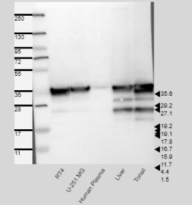 Click to enlarge image Results provided by the Human Protein Atlas (www.proteinatlas.org). Band of predicted size in kDa (+/-20%) with additional bands present. Analysis performed using a standard panel of samples. Antibody dilution: 1:500.