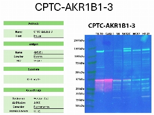 Click to enlarge image Western blot using CPTC-AKR1B1-3 as primary antibody against the whole lysates of TK-10, CAKI-1, SR, SN12C, MCF7, and HT-29. The antibody detected the target protein (~35.8 KDa) in TK-10, CAKI-1, SR, and SN12C cell lysates.