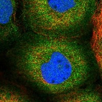 Click to enlarge image Results provided by the Human Protein Atlas (www.proteinatlas.org). The subcellular location is supported by literature. Immunofluorescent staining of human cell line A-431 shows localization to cytosol. Human assay: A-431 fixed with PFA, dilution: 1:200
Human assay: U-2 OS fixed with PFA, dilution: 1:200
Human assay: U-251 MG fixed with PFA, dilution: 1:200