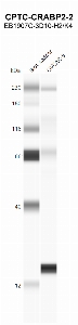 Click to enlarge image Automated western blot using CPTC-CRABP2-2 as primary antibody against OVCAR-3 cell lysate. Molecular weight standards are also included.