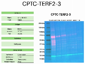 Click to enlarge image Western blot using CPTC-TERF2-3 as primary antibody against the whole lysates of SW-620, HCC-2998, SK-OV-3, HS 578T, IGROV-1, and SR. The antibody detected the target protein (~59.6 KDa) in SW-620, HCC-2998, and SK-OV-3 cell lysates.