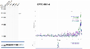 Click to enlarge image Automated western blot using CPTC-RB1-6 as primary antibody against whole lysates of cell lines CCRF-CEM, HeLa, Jurkat, K-562 and MCF7. Protein molecular weight is about 106 KDa. The antibody cannot recognize the target in any of the tested lysates. Loading controls were run with anti-GAPDH antibody.