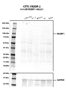 Click to enlarge image Western blot using CPTC-PAXBP1-2 as primary antibody against human cell lysates CCRF-CEM, K-52, MOLT-, SR and Jurkat whole cell lysates.  Expected MW is about 105 kDa. The antibody CPTC-PAXBP1-2 does not recognize the endogenous protein in any of the tested lysates.