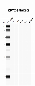 Click to enlarge image Autoamted Western Blot using CPTC-SNAI2-2 as primary antibody against cell lysates A549, H226, HeLa, Jurkat and MCF7. Expected MW of 30.0 KDa. All cell lysates negative.  Molecular weight standards are also included (lane 1).