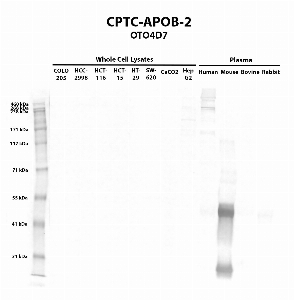 Click to enlarge image Western blot using CPTC-APOB-2 as primary antibody against COLO205 (lane 2), HCC-2998 (lane 3), HCT-116 (lane 4), HCT-15 (lane 5), HT-29 (lane 6), SW-620 (lane 7), CaCO2 (lane 8), Hep G2 (lane 9) whole cell lysates and human (lane 10), mouse (lane 11), bovine (lane 12), and rabbit (lane 13) plasma. Expected molecular weight – 516 kDa.  Molecular weight standards are also included (lane 1).  HepG2 and human plasma are positive.