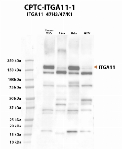 Click to enlarge image Western Blot using CPTC-ITGA11-1 as primary antibody against cell lysate of human mesenchymal stem cells (hMSC), A549, HeLa and MCF7. The antibody CPTC-ITGA11-1 presumably recognizes the target protein in hMSC A549, HeLa and MCF7 lysates. Expected MW is 133 KDa, but ITGA11 glycosylation affects its migration.