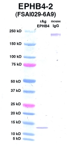Click to enlarge image Western Blot using CPTC-EPHB4-2 as primary Ab against EPHB4 (Ag 10657) (lane 2). Also included are molecular wt. standards (lane 1) and mouse IgG control (lane 3).