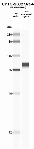 Click to enlarge image Western Blot using CPTC-SLC27A3-4 as primary Ab against SLC27A3 HEK293T cell transient overexpression lysate (lane 2). Also included are molecular wt. standards.