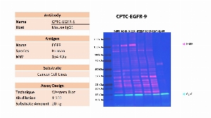 Click to enlarge image Western blot using CPTC-EGFR-9 as primary antibody against the whole cell lysates of A498, ACHN, H226, H322M, CCRF-CEM and HL-60. The antibody is presumably able to detect the target protein in the cell lines A498, ACHN, and H226. Expected MW is 134 KDa. The same membrane was probed with an anti-CytC antibody. Vinculin was detected in  all tested cell lines.