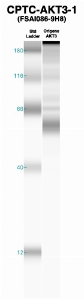 Click to enlarge image Western Blot using CPTC-AKT3-1 as primary Ab against recombinant AKT3 (lane 2). Also included are molecular wt. standards (lane 1).