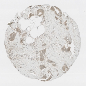 Click to enlarge image Tissue Micro-Array (TMA) core of breast cancer  showing cytoplasmic and membranous staining using Antibody CPTC-IFNGR1-3. Titer: 1:1000