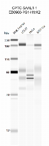 Click to enlarge image Western Blot using CPTC-SAAL1-1 as primary antibody against cell lysates LCL57 (lane 2), HeLa (lane 3) and MCF10A (lane 4). Also included are molecular weight standards (lane 1).