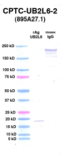 Click to enlarge image Western Blot using CPTC-UB2L6-2 as primary Ab against UB2L6 (rAg 00012) (lane 2). Also included are molecular wt. standards (lane 1) and mouse IgG control (lane 3).