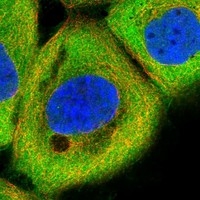 Click to enlarge image Results provided by the Human Protein Atlas (www.proteinatlas.org). The subcellular location is partly supported by literature or no literature is available. Immunofluorescent staining of human cell line A-431 shows localization to plasma membrane & cytosol. Human assay: A-431 fixed with PFA, dilution: 1:20
Human assay: U-2 OS fixed with PFA, dilution: 1:20
Human assay: U-251 MG fixed with PFA, dilution: 1:20