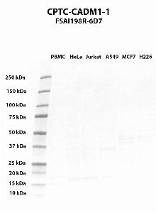 Click to enlarge image Western blot using CPTC-CADM1-1 as primary antibody against PBMC (lane 2), HeLa (lane 3), Jurkat (lane 4), A549 (lane 5), MCF7 (lane 6), and NCI-H226 (lane 7) whole cell lysates.  Expected molecular weight - 48.5 kDa, 36.9 kDa, 51.5 kDa, 49.6 kDa, and 45.6 kDa.  Molecular weight standards are also included (lane 1).