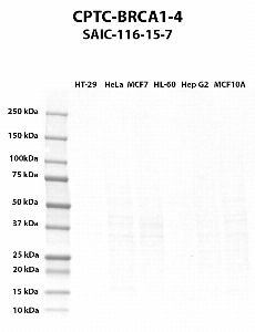 Click to enlarge image Western blot using CPTC-BRCA1-4 as primary antibody against HT-29 (lane 2), HeLa (lane 3), MCF7 (lane 4), HL-60 (lane 5), Hep G2 (lane 6), and MCF7 (lane 7) whole cell lysates.  Expected molecular weight - 208 kDa, 7 kDa, 85 kDa, 206 kDa, 81 kDa, 78 kDa, 210 kDa, and 202 kDa.  Molecular weight standards are also included (lane 1).