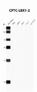 Click to enlarge image Automated Western Blot using CPTC-LBX1-2 as primary antibody against cell lysates A549, H226, HeLa, Jurkat and MCF7. Expected MW of 30.2 KDa. All cell lysates negative.  Molecular weight standards are also included (lane 1).