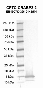 Click to enlarge image Western blot using CPTC-CRABP2-2 as primary antibody against CRABP2 recombinant protein. Molecular weight standards are included.