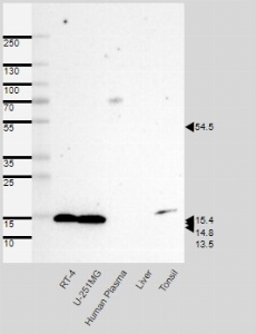 Click to enlarge image Results provided by the Human Protein Atlas (www.proteinatlas.org). Band of predicted size in kDa (+/-20%) with additional bands present.
Analysis performed using a standard panel of samples. Antibody dilution: 1:500