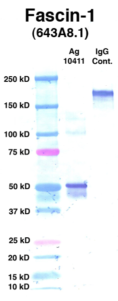 Click to enlarge image Western Blot using CPTC-Fascin 1-1 as primary Ab against Ag 10411 (lane 2). Also included are molecular wt. standards (lane 1) and mouse IgG control (lane 3).