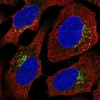 Click to enlarge image Results provided by the Human Protein Atlas (www.proteinatlas.org). The subcellular location is supported by literature. Immunofluorescent staining of human cell line U-2 OS shows localization to the Golgi apparatus. Human assay: HeLa fixed with PFA, dilution: 1:2000
Human assay: MCF7 fixed with PFA, dilution: 1:2000
Human assay: U-2 OS fixed with PFA, dilution: 1:2000