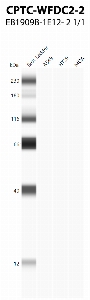 Click to enlarge image Western Blot using CPTC-WFDC2-2 as primary antibody against cell lysates A549, HT-29, MBA-MB-231. Molecular weight standards are also included.